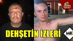 Dehşetin izleri
