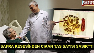 Tekden Hastanesi’nde ender rastlanan safra kesesi ameliyatı