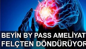 Beyin By Pass Ameliyatı Felçten Döndürüyor