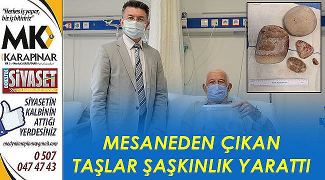 Mesaneden çıkan taşlar şaşkınlık yarattı