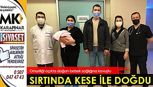 Sırtında kese ile doğdu