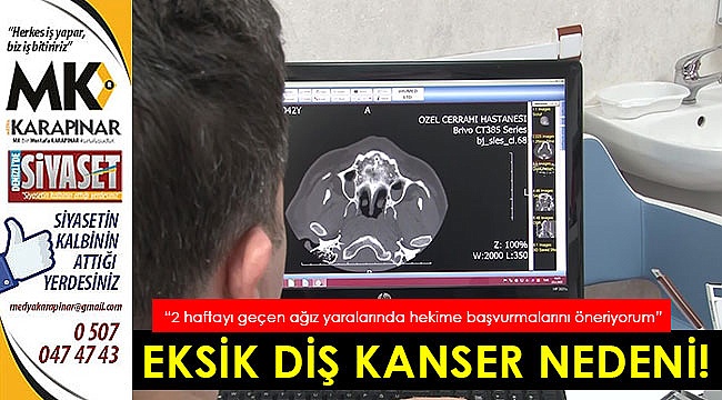 Eksik diş kanser nedeni!