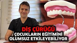 Diş Çürüğü Çocukların Eğitimini Olumsuz Etkileyebiliyor