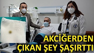 Akciğerden Çıkan Şey Şaşırttı!