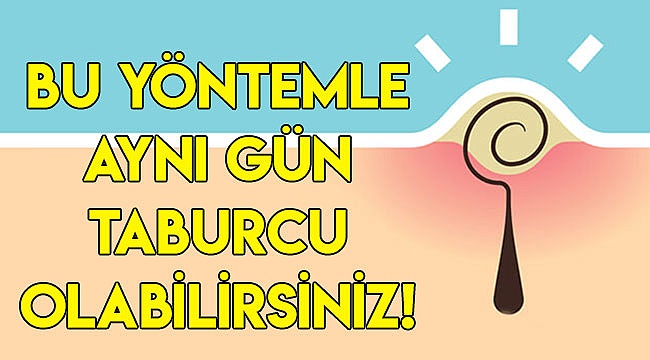 Bu yöntemle aynı gün taburcu olabilirsiniz!