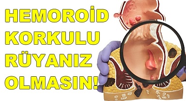 Hemoroid korkulu rüyanız olmasın!