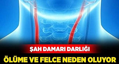 Şah damarı darlığı ölüme ve felce neden oluyor